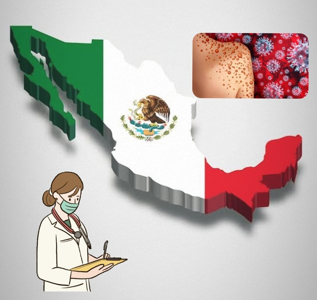 ¿Vas a Cancún? Q. Roo es el segundo estado con más casos de Mpox